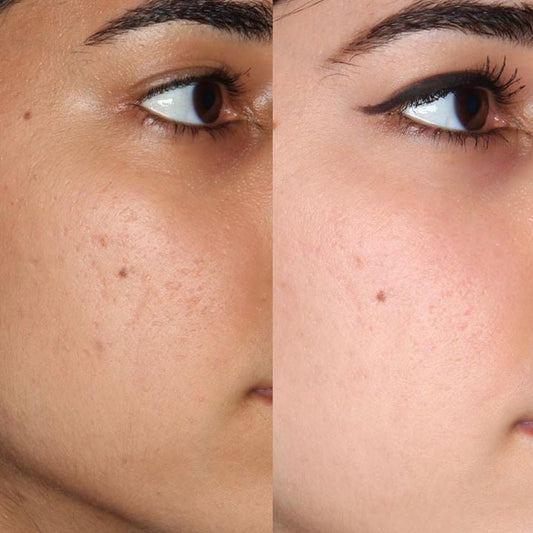 Pure Glow Face kit 3pc set